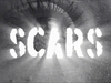 U2 - Scars